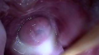 Injection Nut-juice Jizm in Cervix Broad Spreading Puss Ass-plug