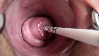 Uterus have fun with Asian sounding injection